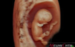 Врожденные пороки развития у детей: как выявить на ранней стадии беременности