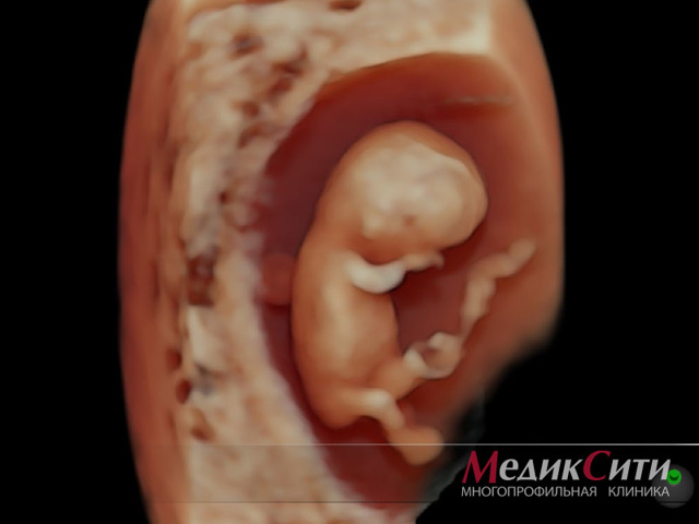 Врожденные пороки развития у детей: как выявить на ранней стадии беременности
