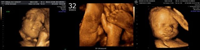 Развитие ребенка на 32 неделе беременности: интересные сведения для будущей мамы